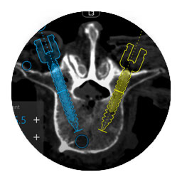 Spine Map R&D