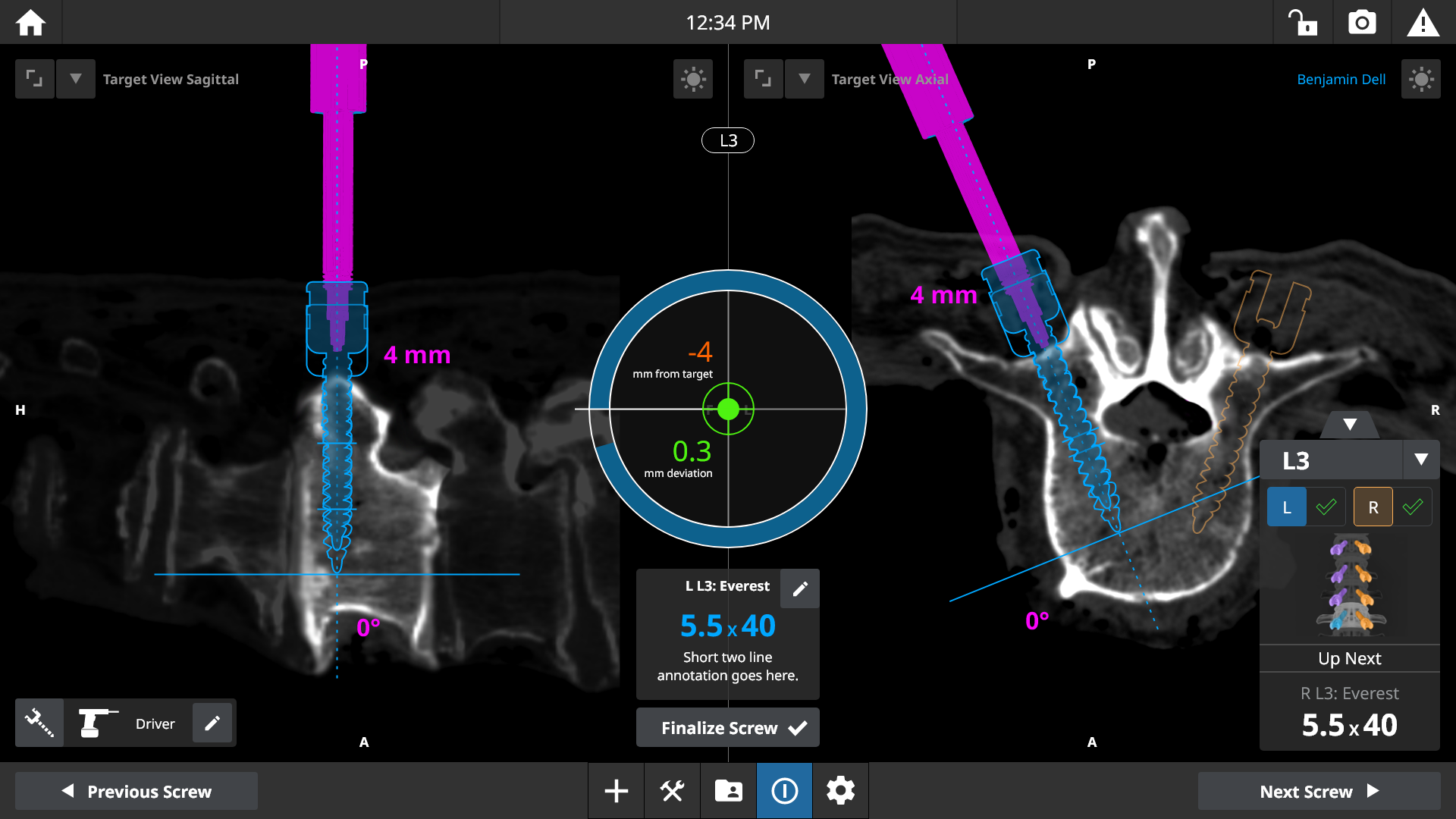 Spine Map